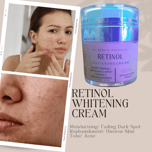 A&T Retinol Whitening Moisturizer™ – Best Cream for Hyperpigmentation | 50 ml